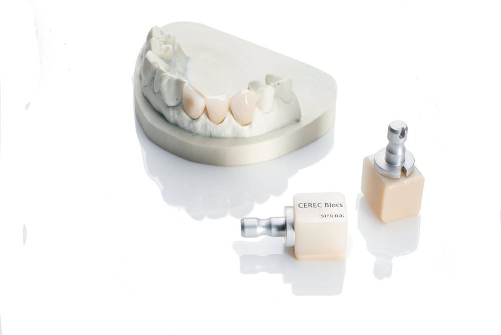 Was ist Cerec? ZahnarztPraxis Dr. Matthias Funk Raubling Was ist Cerec? ZahnarztPraxis Dr. Matthias Funk Raubling